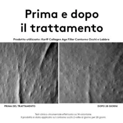 Korff Collagen Age Filler Contorno Occhi E Labbra 15 Ml -Vendite ROSSETTI korff collagen age filler contorno occhi e labbra 15 ml 2